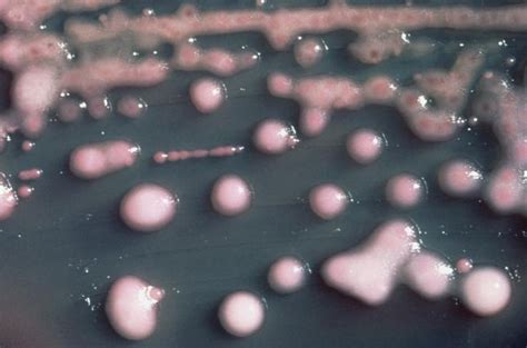 Newly Emerged Superbug Hyper Resistant And Hypervirulent Klebsiella