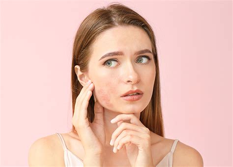 Dermatite viso cos è cause tipologie e come curarla