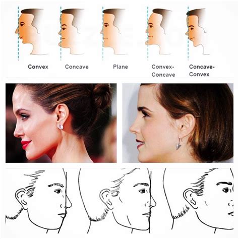 Concave Vs Convex Face