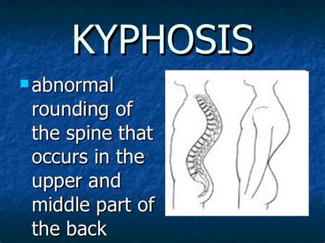 Common Diseasesdisorders Of The Skeletal System
