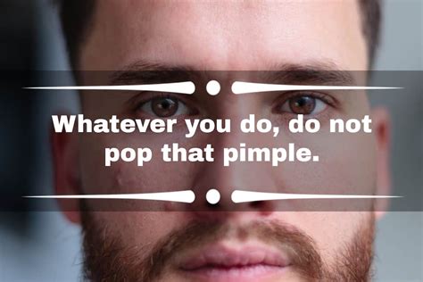 35 Pimples Quotes And Captions To Boost Your Confidence Ke