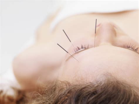 Is Facial Acupuncture The New Botox Anchor Acupuncture And Wellness