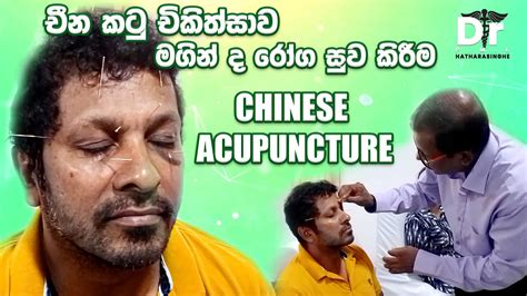චීන කටු චිකිත්සාව මගින් ද රෝග සුව කිරීම Chinese Acupuncture Dr P M L Hatharasinghe Ep 07
