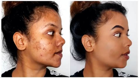 How To Cover Acne Marks Dark Spots With Makeup Drugstore Easy