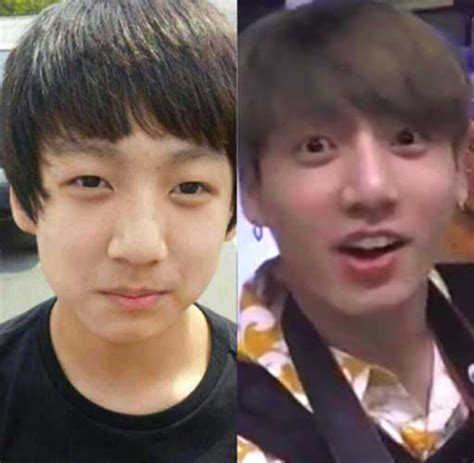 Bts Before And After Plastic Surgery Jungkook Bts Proof Debut Surgery