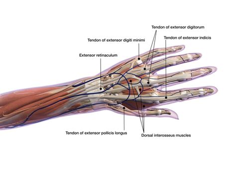 Flexor Tendon Tear Heiden Orthopedics