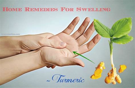 15 Home Remedies For Swelling In Hands And Feet From An Injury