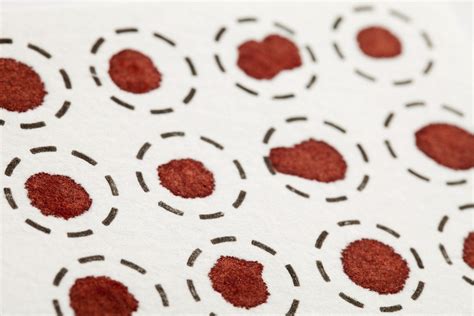 Dried Blood Spot Testing Innovations And Applications The Doctor