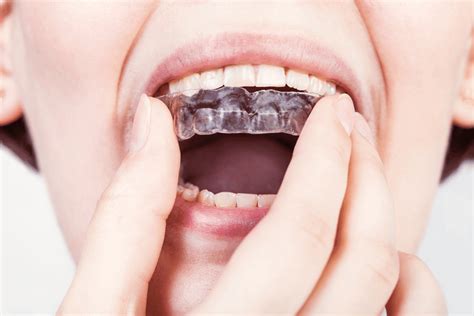 Tips For Dealing With Invisalign Pain During Treatment — Legacy
