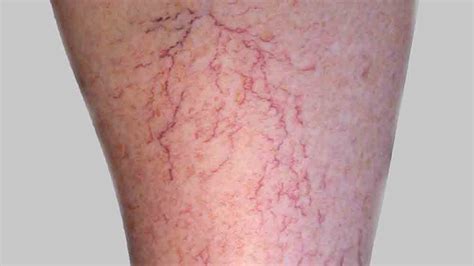When To Worry About A Rash In Adults Healthella