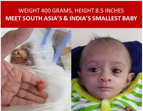 This Miracle Baby Born Weighing Just 14 Ounces Beat The Odds And