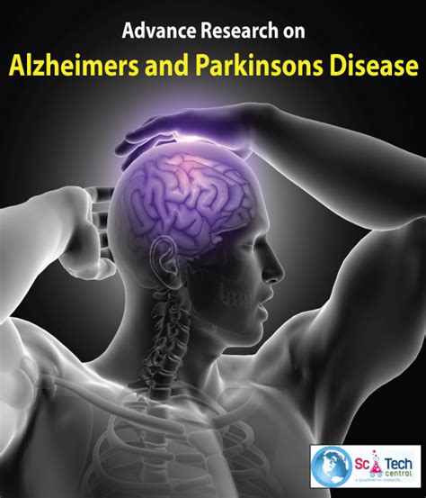Scitech Advance Research On Alzheimers And Parkinsons Disease Arap