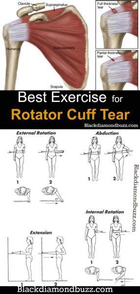 Best Exercise For Rotator Cuff Tear Rotator Cuff Rotator Cuff Injury