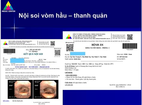 Vietnamese Medic Ultrasound Case Thyroid Tumor Dr Phan Thanh H I