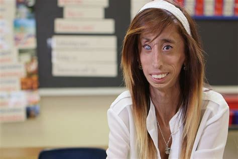 Woman Labelled Worlds Ugliest Woman Forgives Haters Eternity News