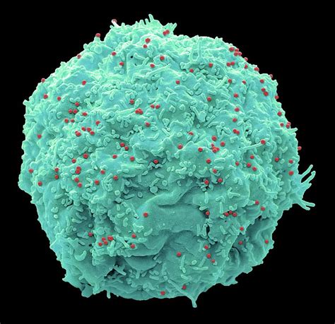 Hiv Infected Cell Photograph By Steve Gschmeissnerscience Photo