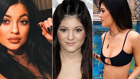 Plastic Surgeons Weigh In On Kylie Jenner S Dramatic TransformationDid She Go Under The Knife