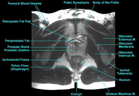 Pelvic Floor Muscles Anatomy Ct Review Home Co