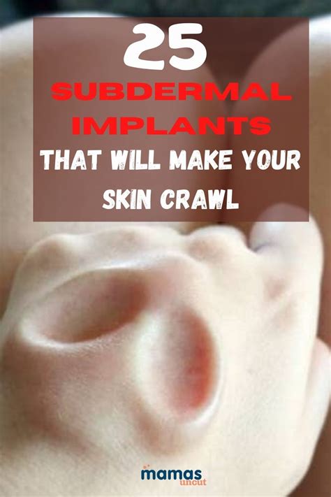 Superb Subdermal Implants That Will Make Your Skin Crawl In Implants Make It Yourself