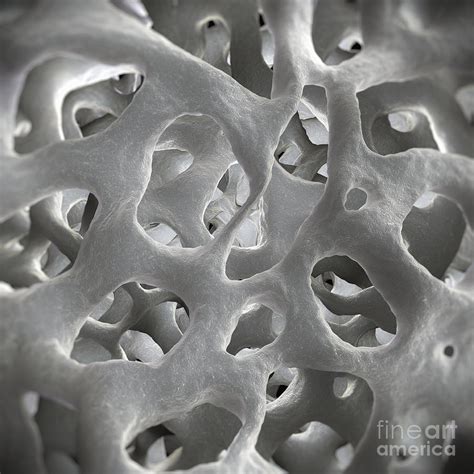 Cancellous Bone Photograph By Science Picture Co Fine Art America