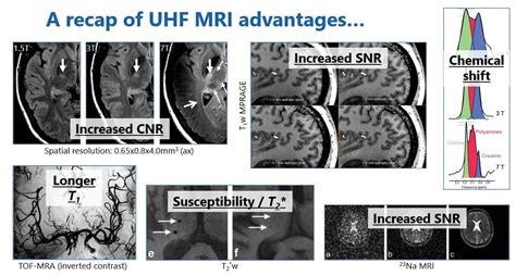 High Field Versus Low Field Mri Is It Time For A Rethink Physics World