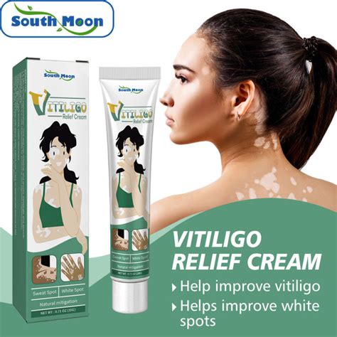 South Moon Vitiligo Relief Cream Herbal Extract Vitiligo Ointment