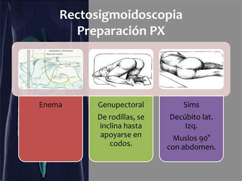 Ppt Tacto Rectal Powerpoint Presentation Free Download Id