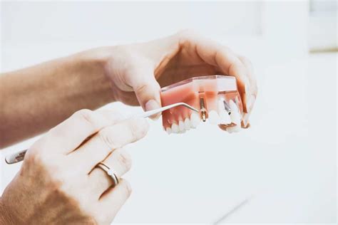 Inlay Core Guide Complet Sur La Prothèse Dentaire Nutrident