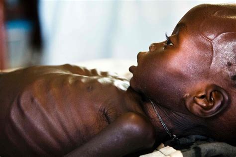 Famine Declared For More Than 100000 In South Sudan 1 Million On The Brink Of Starvation Los
