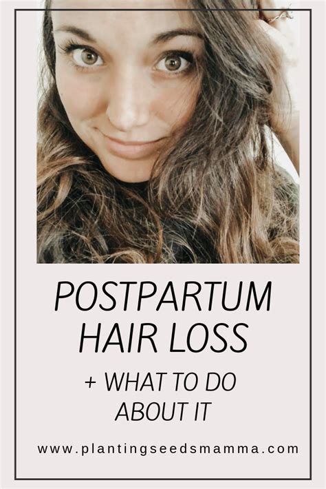 Postpartum Hair Loss And What To Do About It Planting Seeds Mamma Postpartum Hair Loss Hair