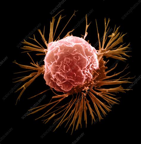 Breast Cancer Cell Stock Image M1220410 Science Photo Library