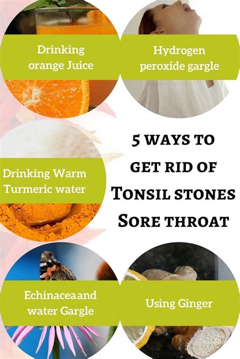 Can Tonsil Stones Cause Sore Throat How To Get Rid Of It