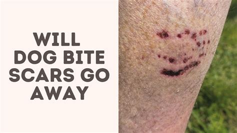 Will Dog Bite Scars Go Away Treat Your Scars