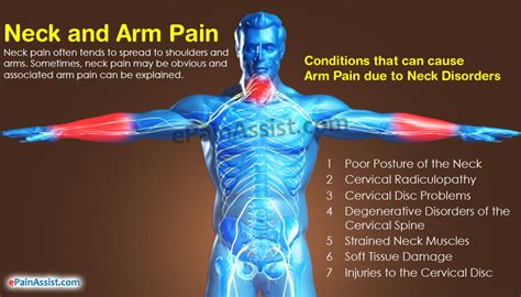 Neck And Arm Pain Can Your Arm Pain Be Related To Neck Pain