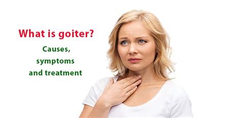 What Is Goiter Causes Symptoms And Treatment Methods