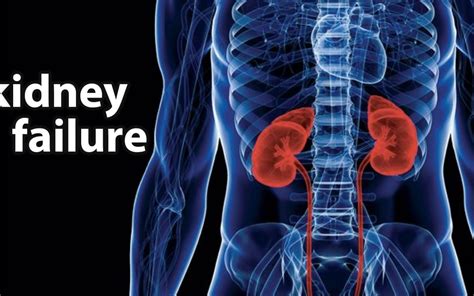 Types Of Kidney Failure United Dialysis Center