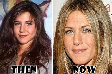 Celebrity Jennifer Aniston Plastic Surgery Before After Pictures