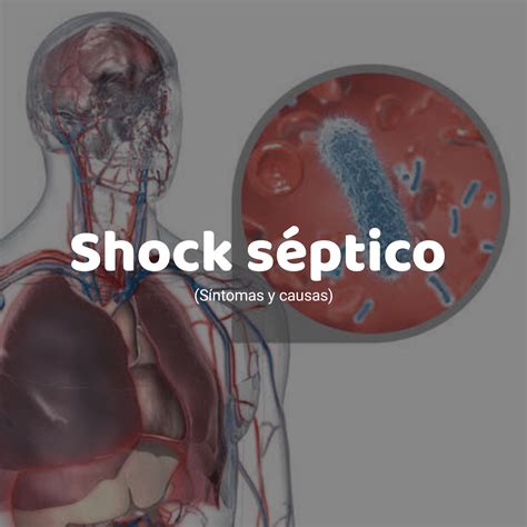 Cid De Choque Séptico Pulmonar