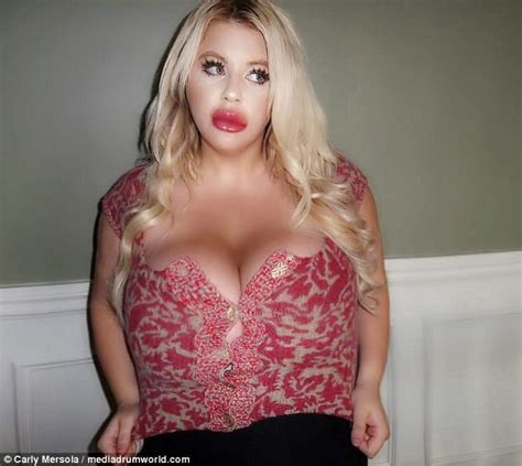 Woman Spends K On Plastic Surgery To Look Like Jessica Rabbit Daily Mail Online