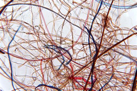 Fascinating Images Of Everyday Objects Under A Microscope Readers Digest