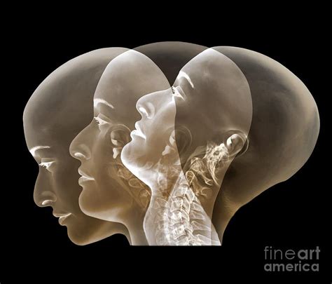 Normal Neck X Rays Photograph By Zephyr Fine Art America