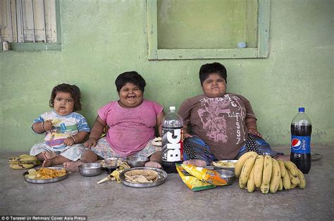 morbidly obese indian sisters get life saving operation daily mail online