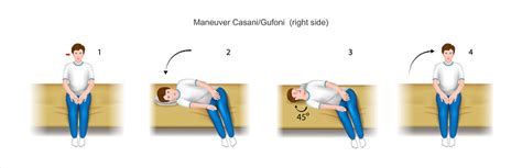 Casani Gufoni Maneuver Right Side Stock Illustration Download Image