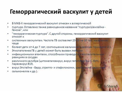 Васкулит геморрагический фото Картинка - Васкулит геморрагический фото