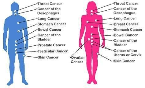 Illustration Of The Most Common Types Of Cancers In Various Organs