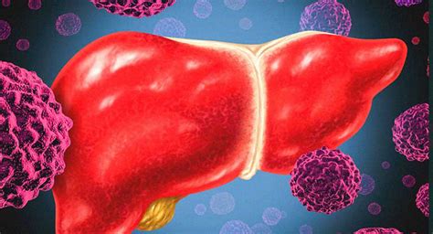 Signs And Symptoms That You Might Be Suffering From Liver Disease