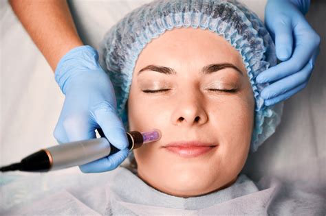Discover The Benefits Of Skinpen Microneedling