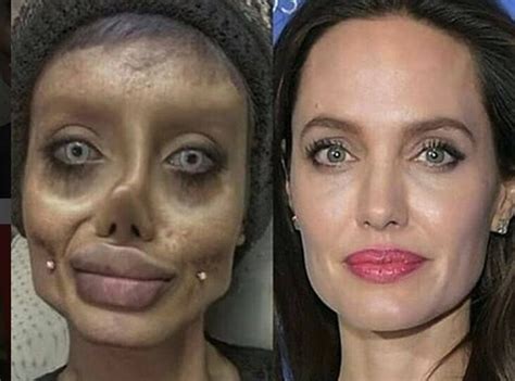 Teen S Botched Angelina Jolie Plastic Surgery Roils Internet Proves To Be An Ingenious Hoax