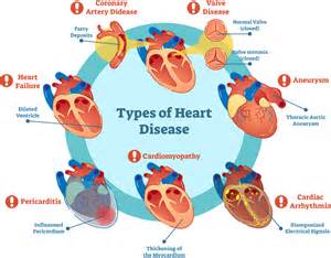 Cardiovascular Diseases Study Guide Inspirit