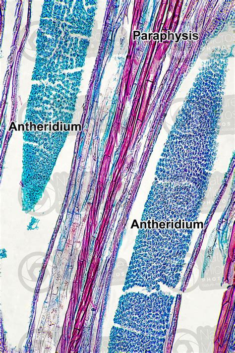 Polytrichum Sp Antheridium Longitudinal Section 250x Polytrichum